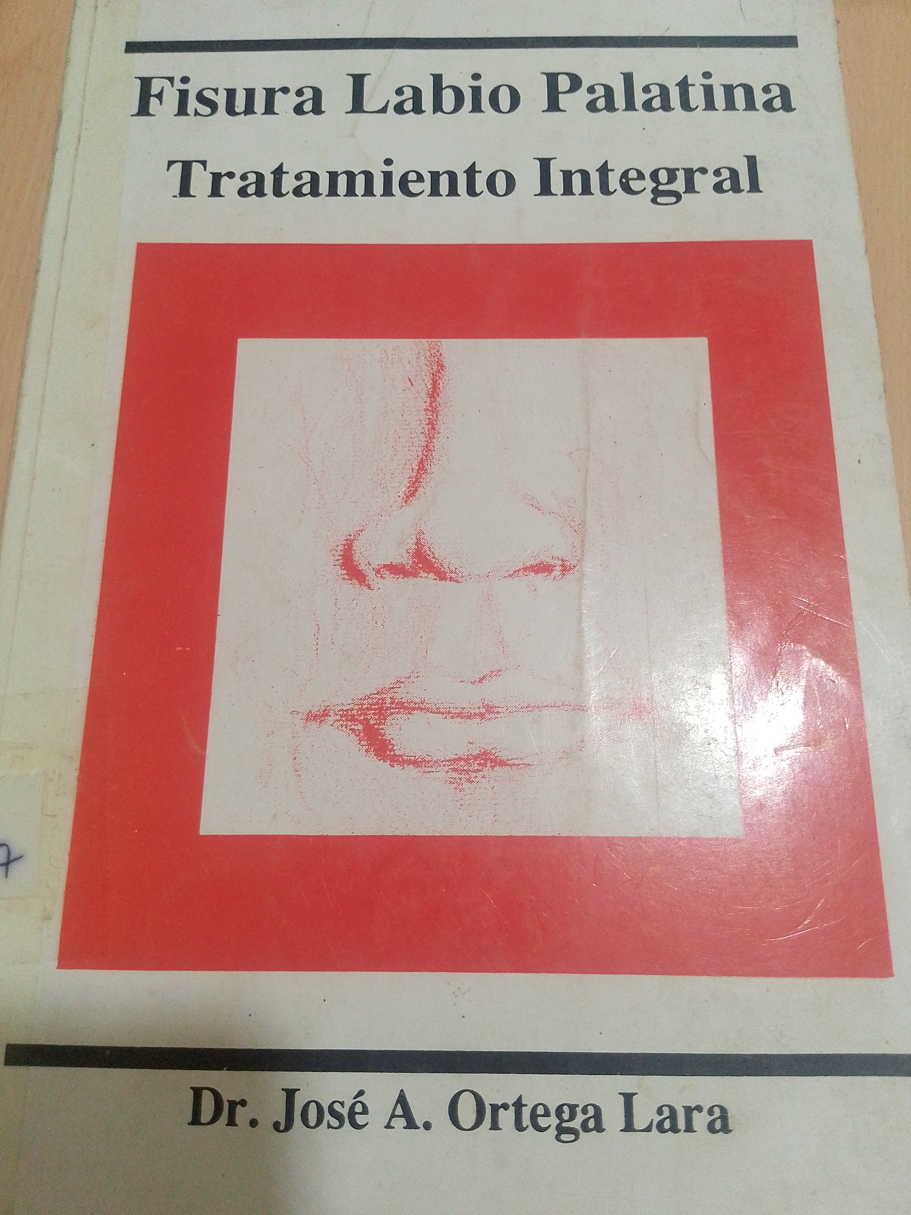 Portada de Fisura Labio palatina tratamiento integral
